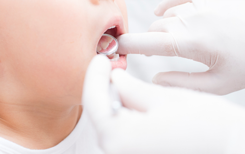 子どもの歯の外傷のイメージ写真