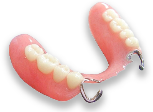 部分入れ歯の写真