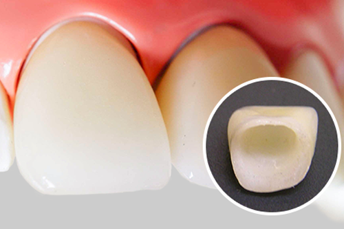 クラウンの写真