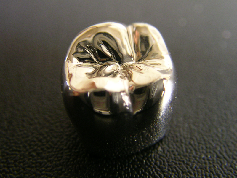 ゴールド素材の被せものの写真