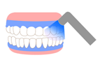 ホワイトニング剤を塗って光を当て、ホワイトニング(イラスト)