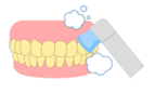 歯の表面の汚れを落とす（イラスト）