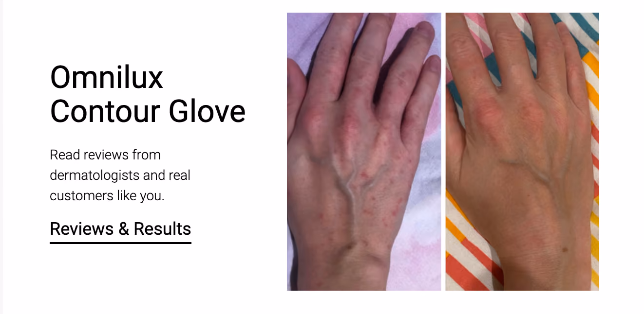 Omnilux Contour Glove