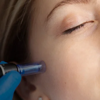 Close-up of a professional skin treatment
