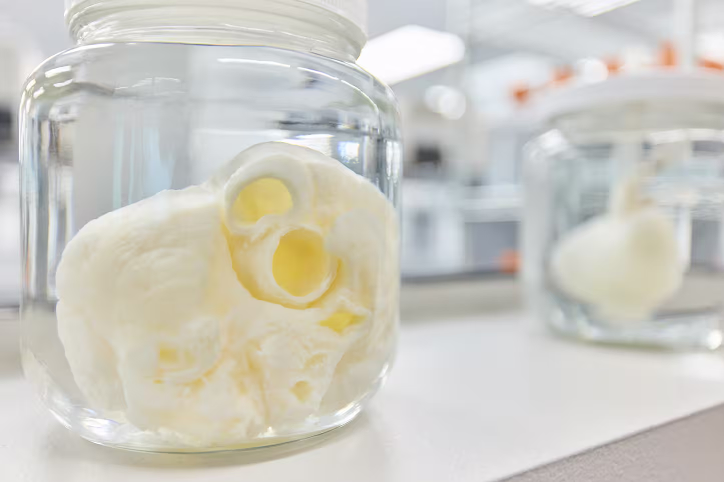 Two glass jars on a white surface each containing a preserved white heart specimen in liquid.