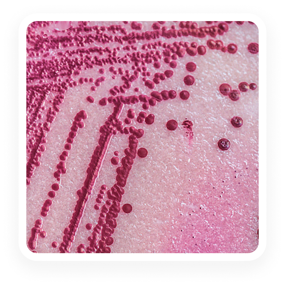 Salmonella & STEC - qPCR
