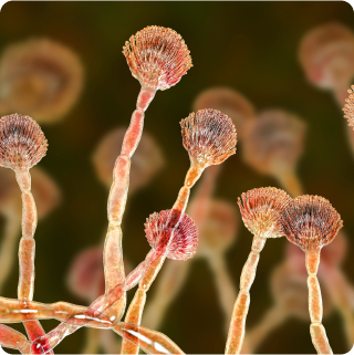 Aspergillus - qPCR