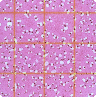 Total Coliforms - Plate
