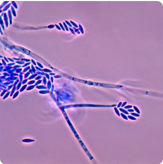 Plant Pathogen - Pan-Fusarium