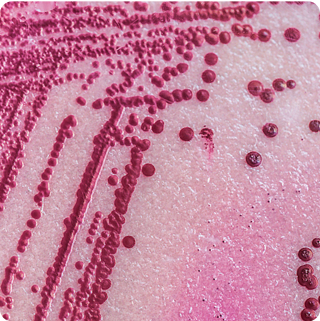Salmonella & STEC - qPCR