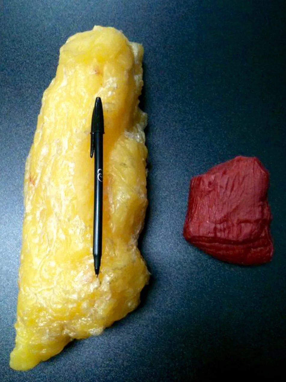 visual comparison of 1lb of fat to 1lb of muscle.  The 1lb of fat tissue is roughly 3 times the size of the 1lb of muscle issue.