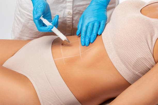 The most effective non-surgical treatments used to reduce stubborn belly fat.