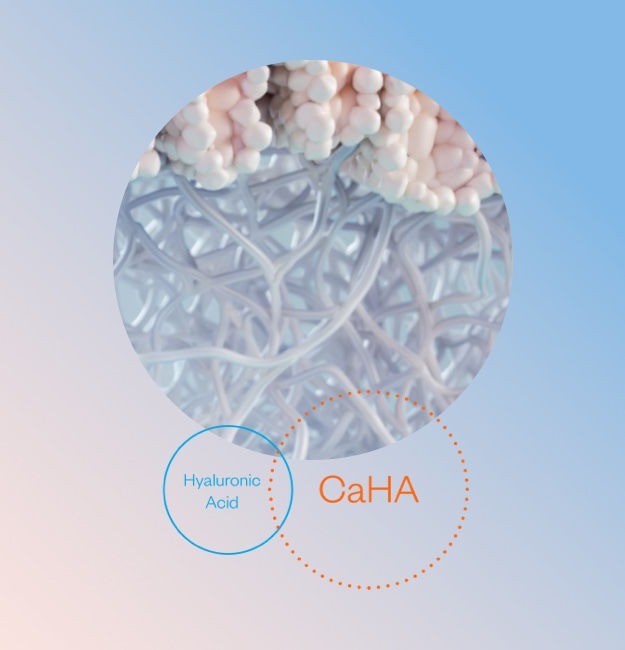 HArmonyCa™ 透明質酸(HA)結合羥基磷灰石鈣(CaHA)示意圖