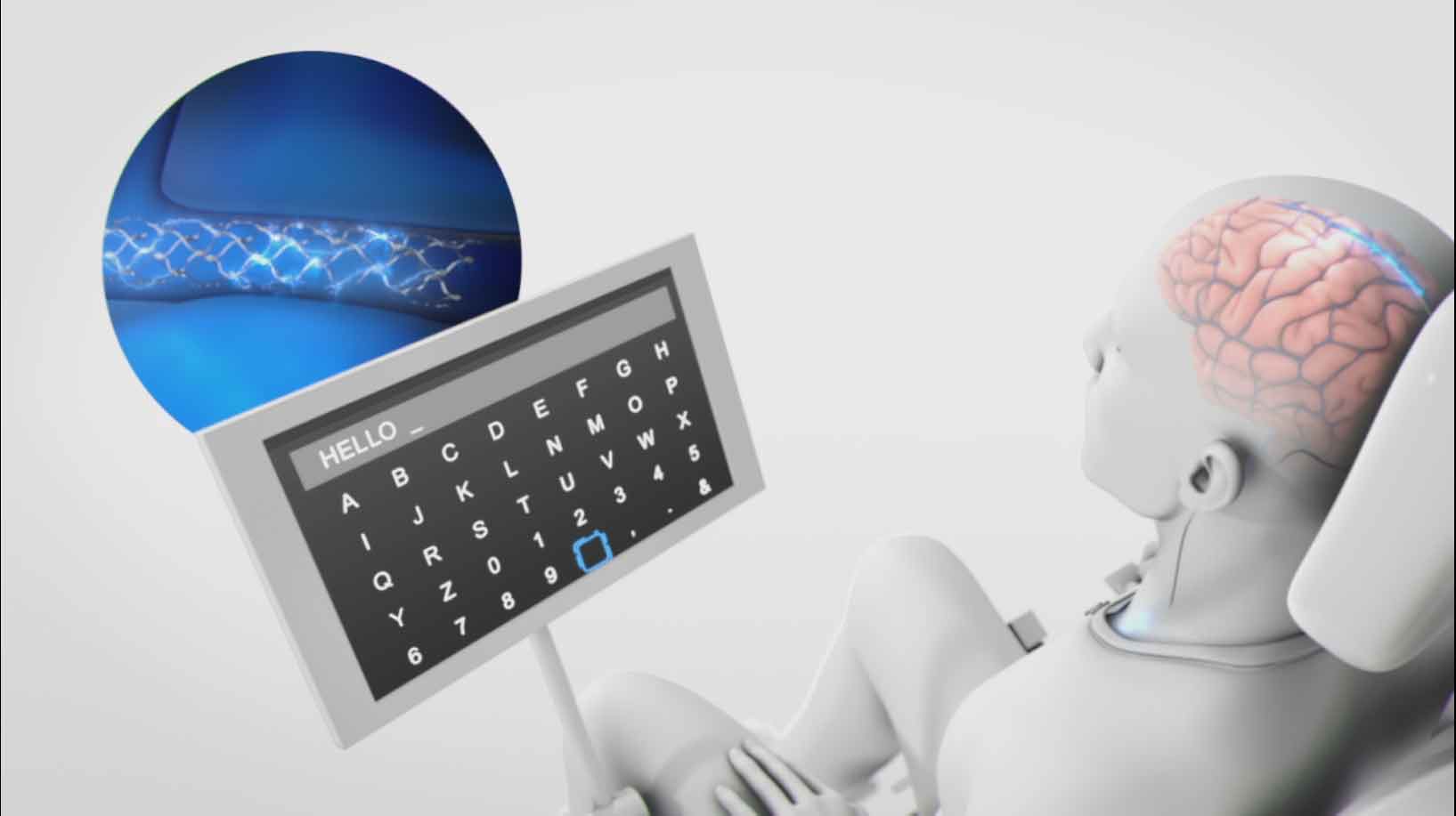 Neurology | Blog Search