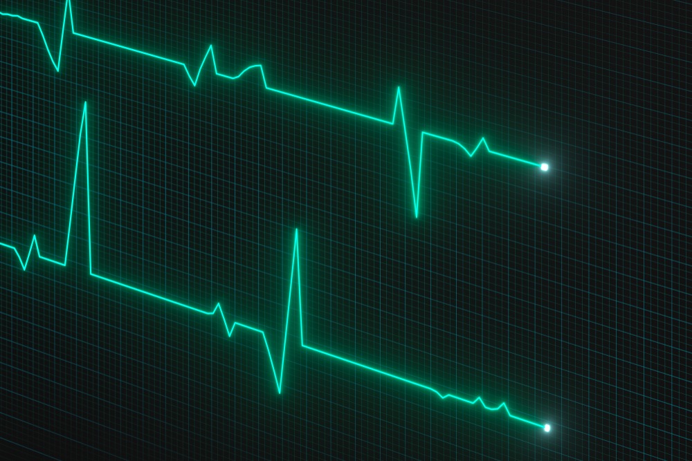 A heart rate monitor symbolising the health of Core Web Vitals. 