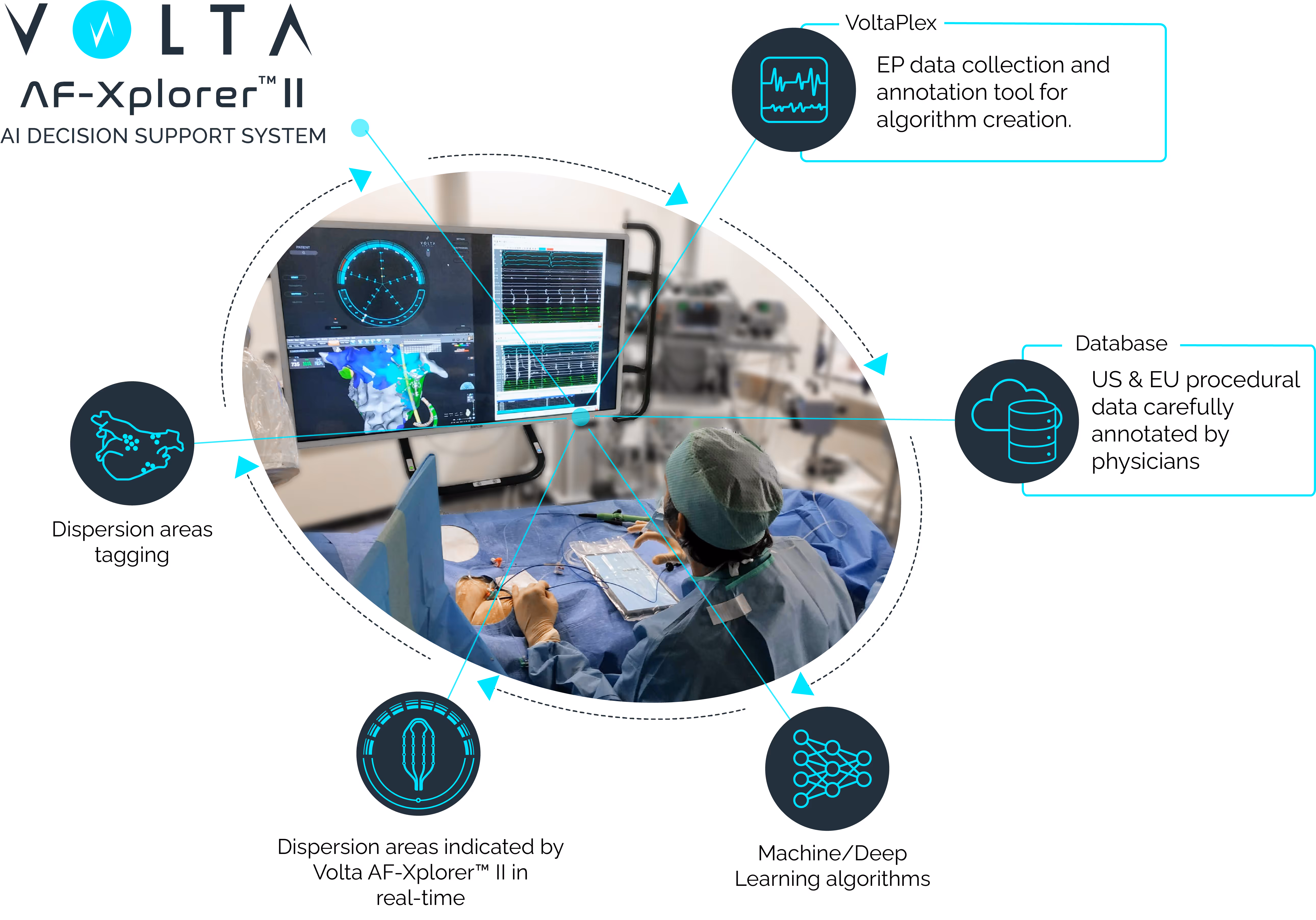 Volta Medical AF-Xplorer graphic