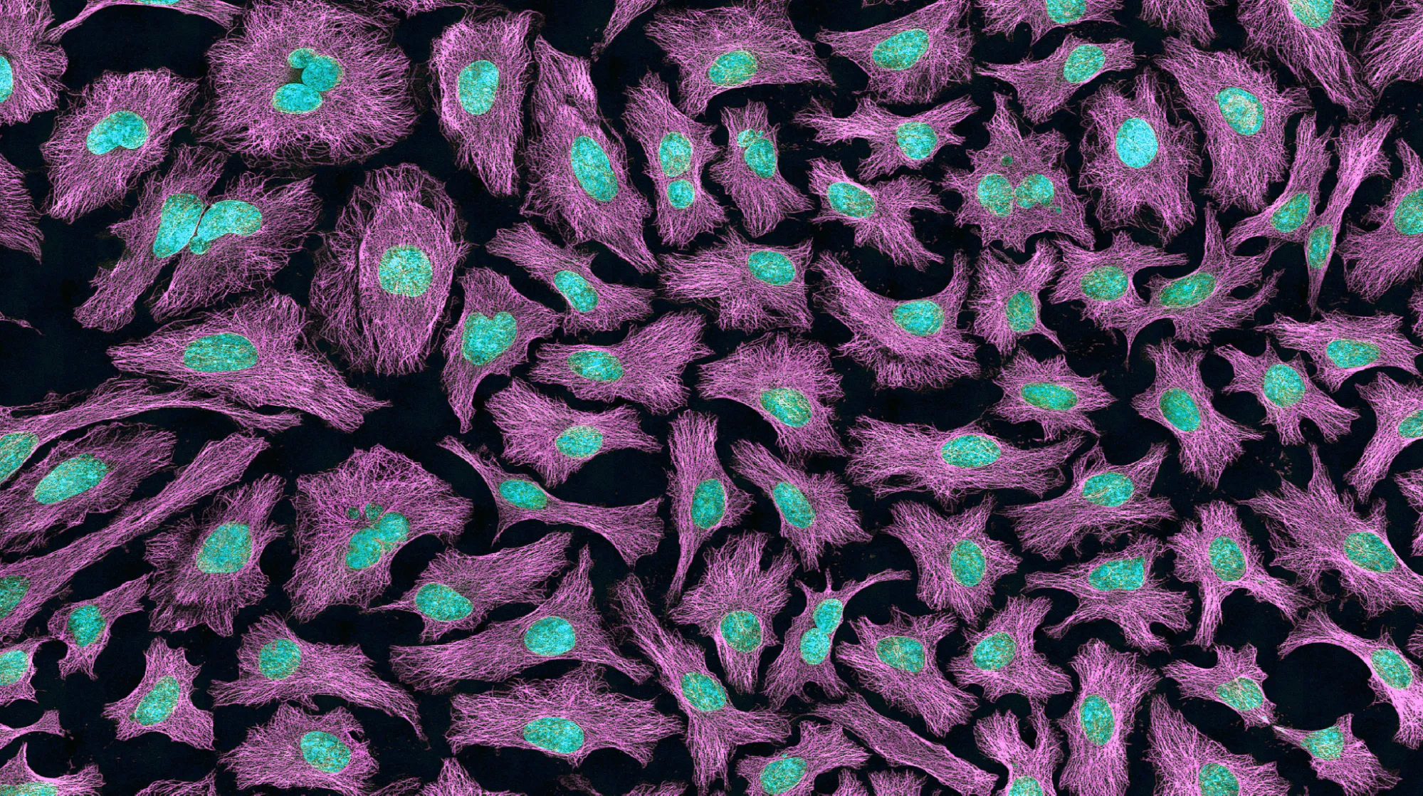  A microscopic image of HeLa cells. The cells fill the image from corner to corner, and are depicted as many different stretched-out, irregular shapes made of web-like bright purple lines. In the middle of each cell is a bright blue circular nucleus. Some cells have more than one nucleus, which suggests that they are in the process of cell division. There is a sense of movement to the image; it is quite striking.