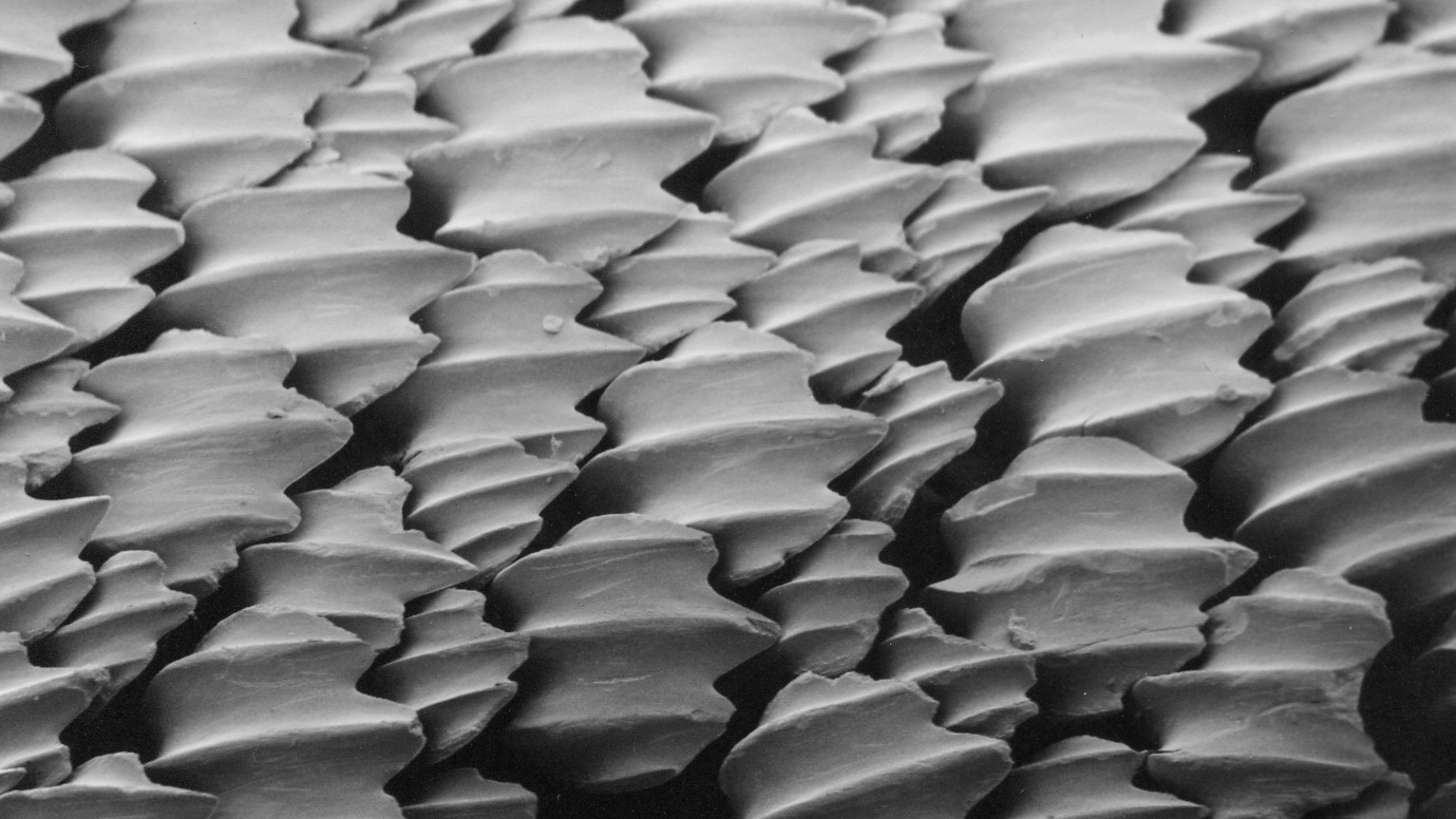 The microscopic dermal denticles of a lemon shark, showing how they are hard, tooth-like structures that all face one direction.