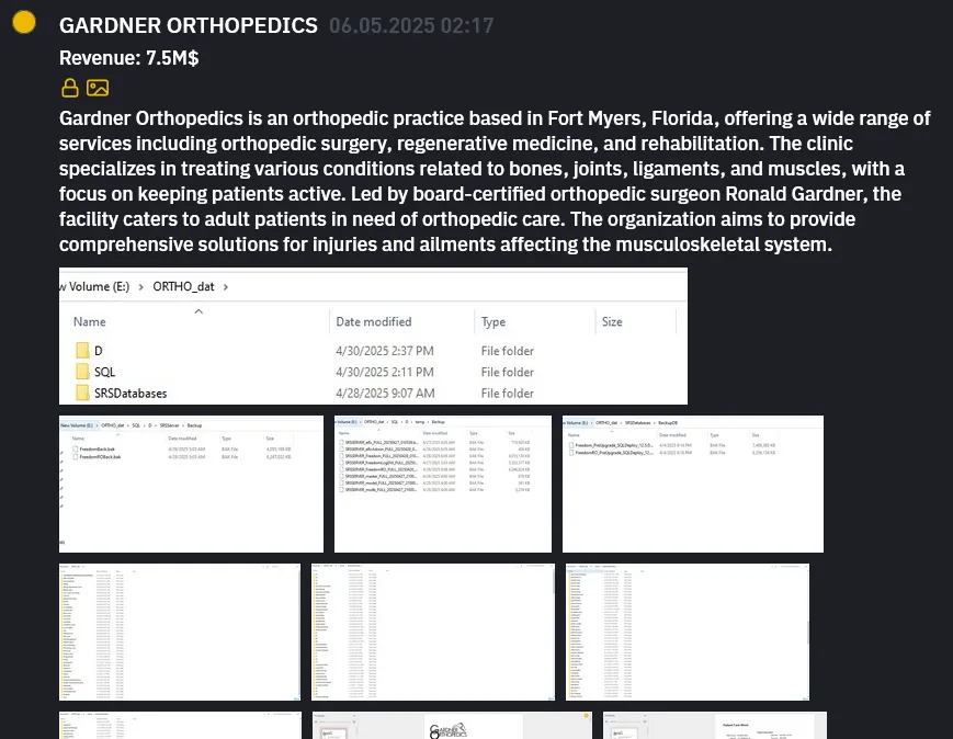 A screenshot of Gardner Orthopedic data on the Dark Web