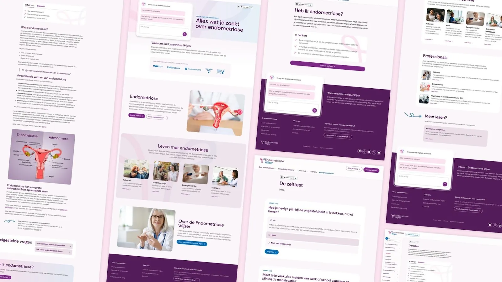 Endometriosewijzer website