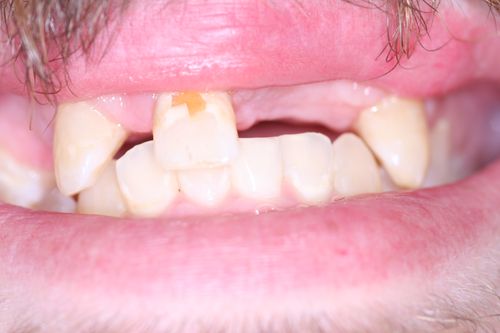 Cosmetic Dentist in Ballwin