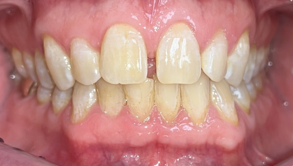 Cosmetic Dentist in Ballwin