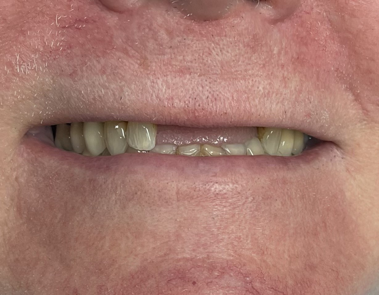 Cosmetic Dentist in Ballwin