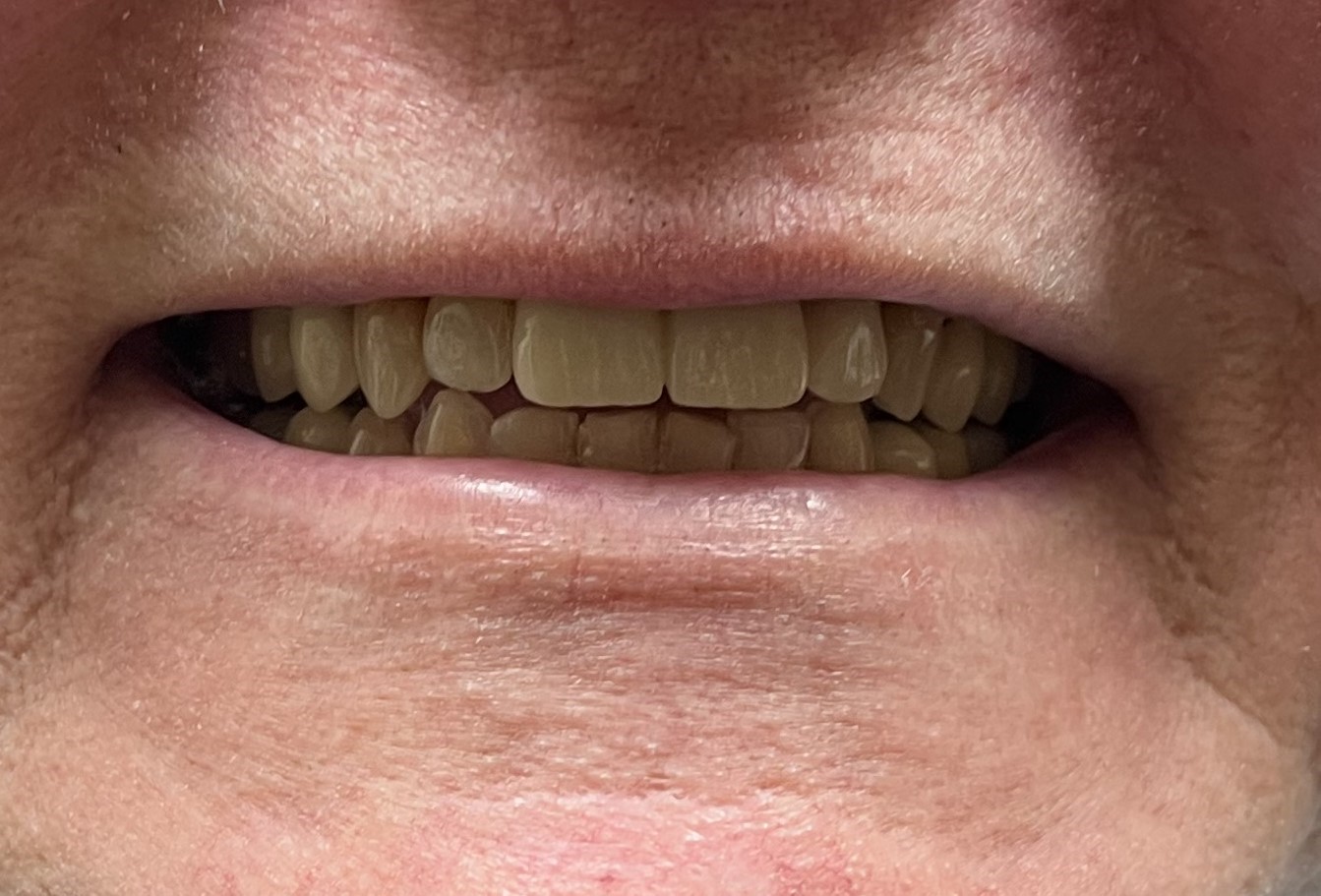 ballwin cosmetic dentist