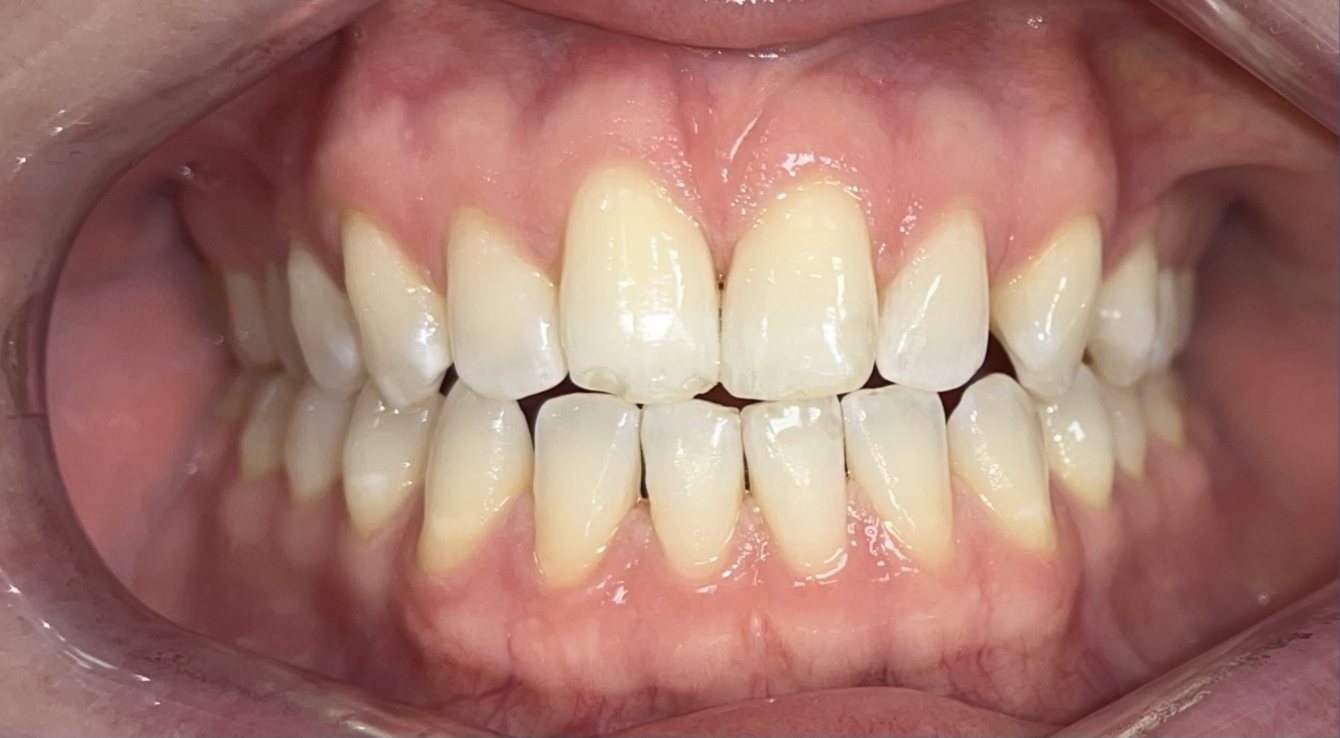 Cosmetic Dentist in Ballwin