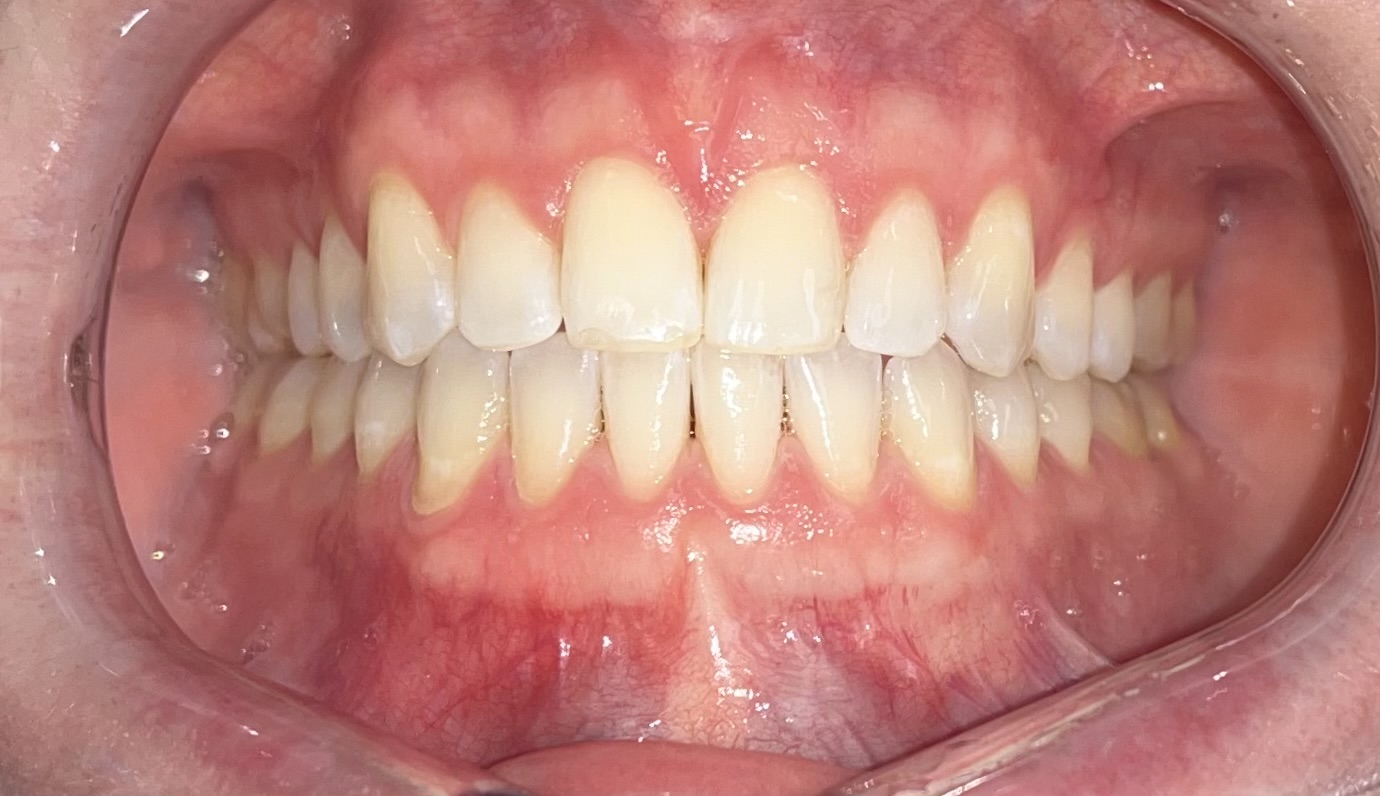 ballwin cosmetic dentist