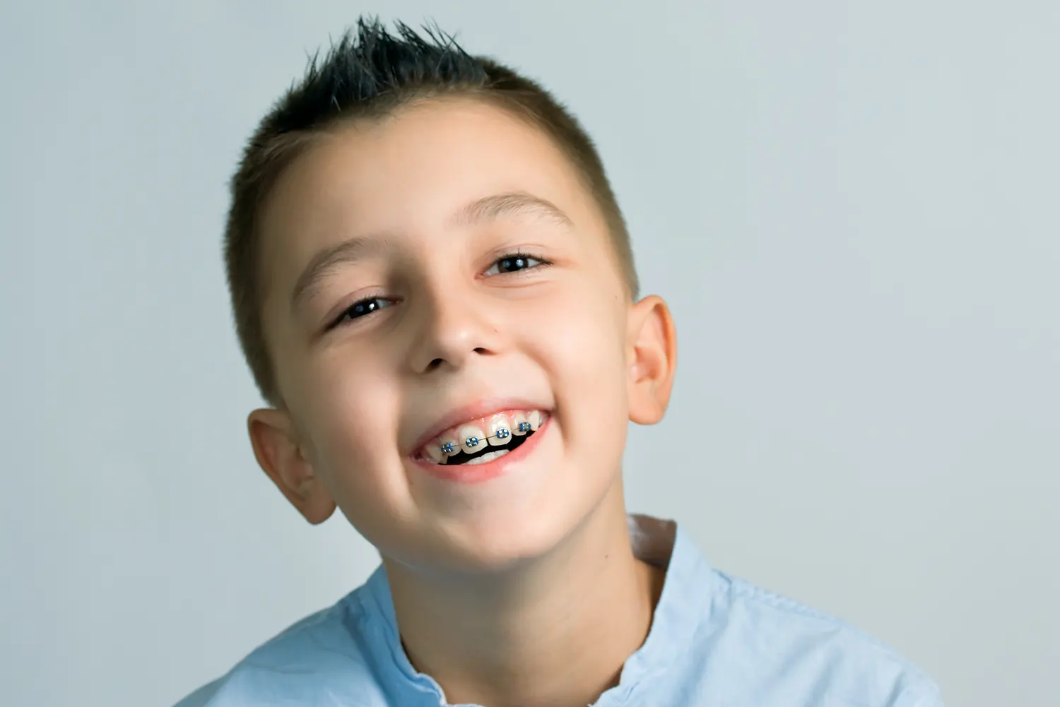 Interceptive Orthodontics: Addressing Bite Problems Early for Better Smiles Tomorrow