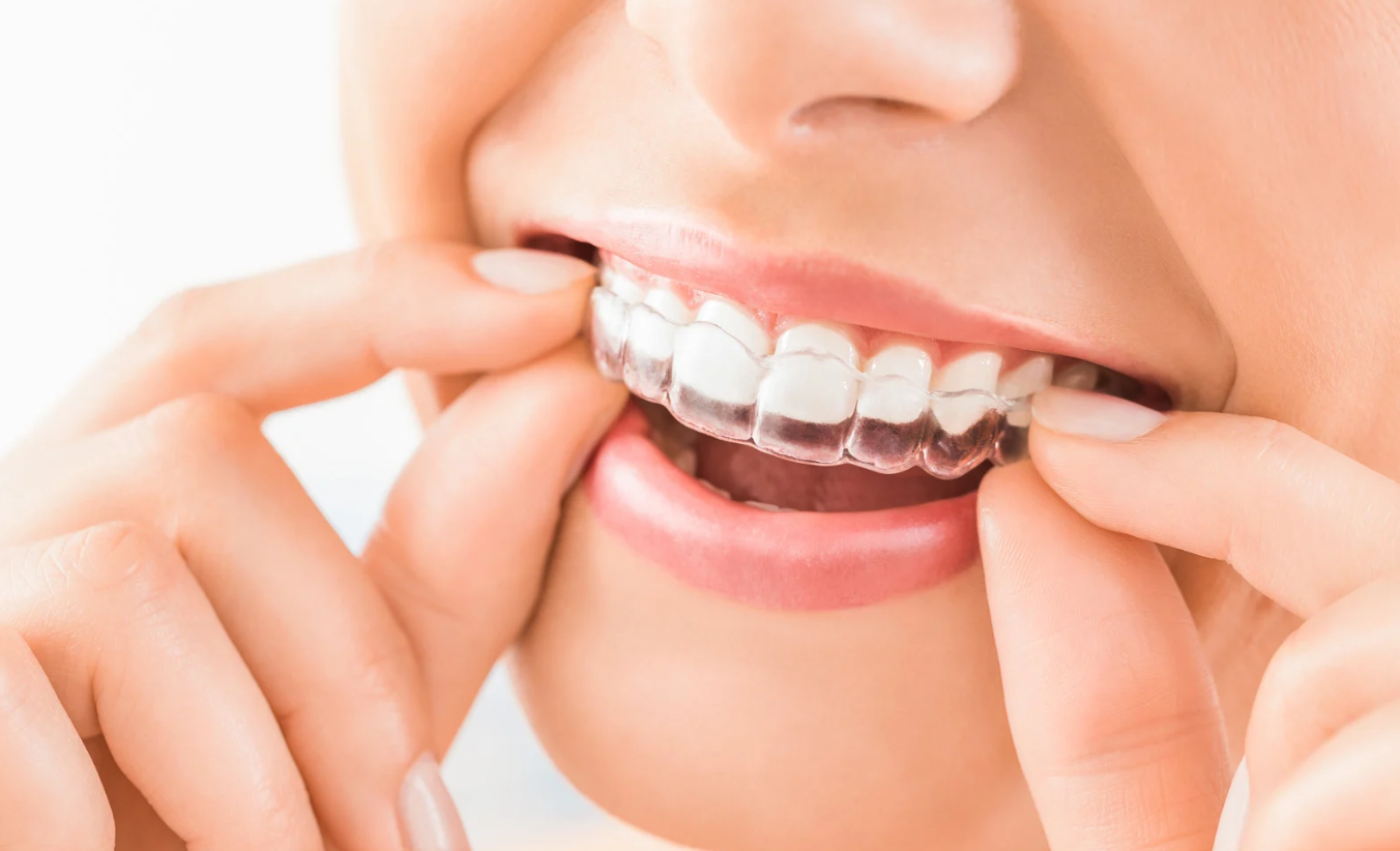 When Does a Child Need Surgical Orthodontics?