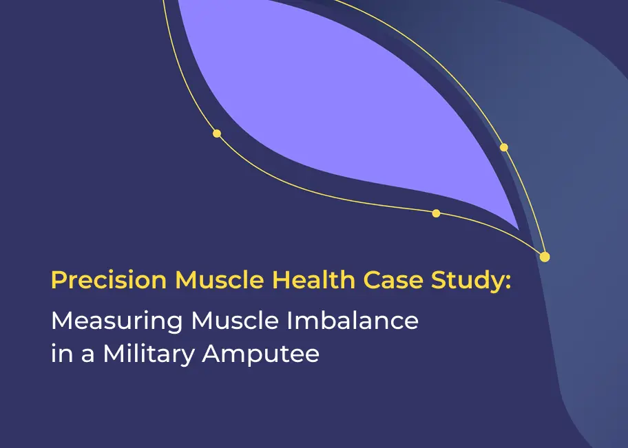 Case study military amputee image