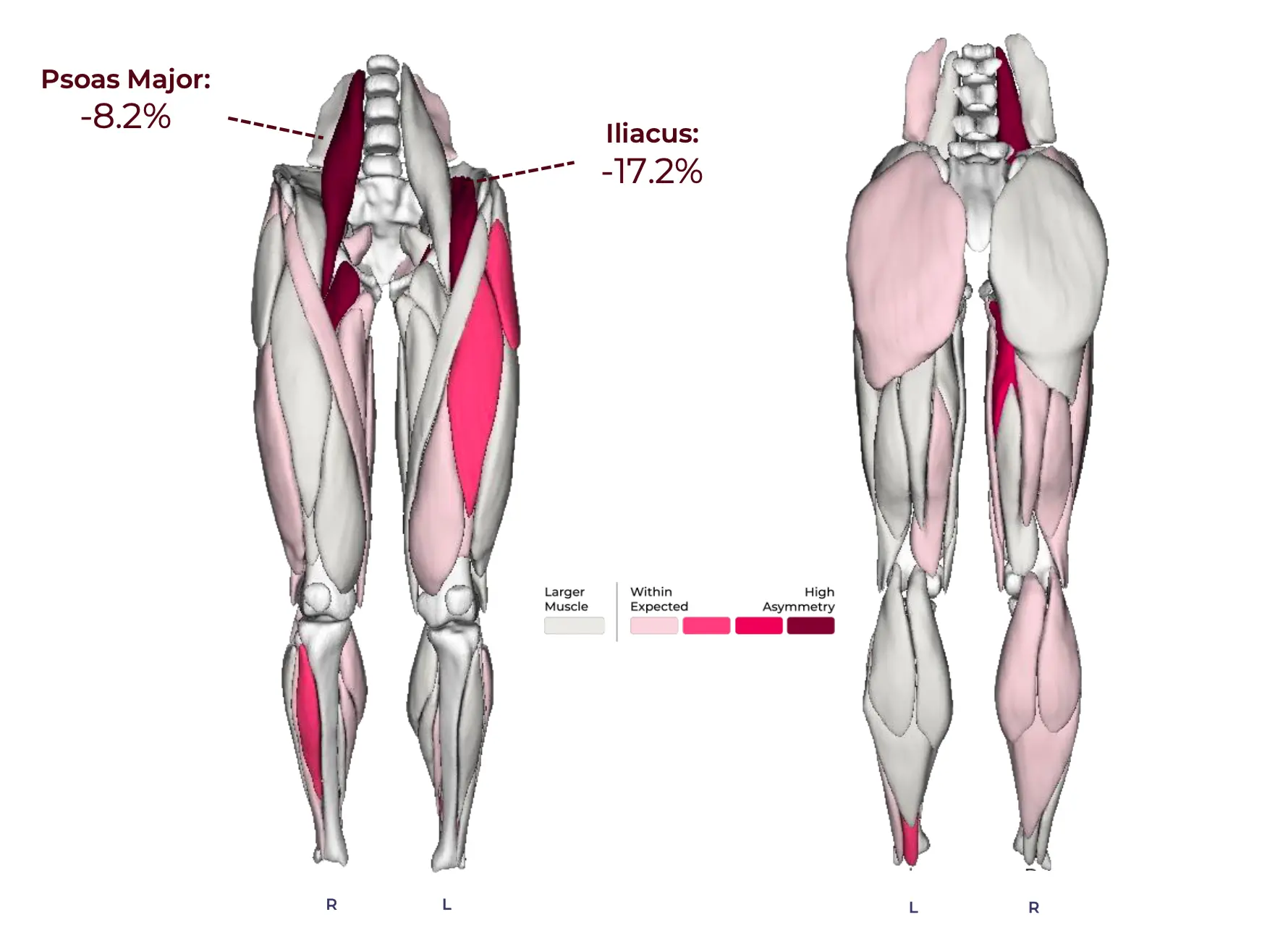 Lower back pain scan image