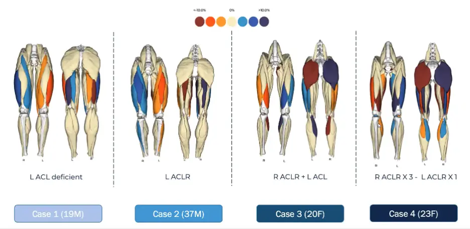 recovery webinar image