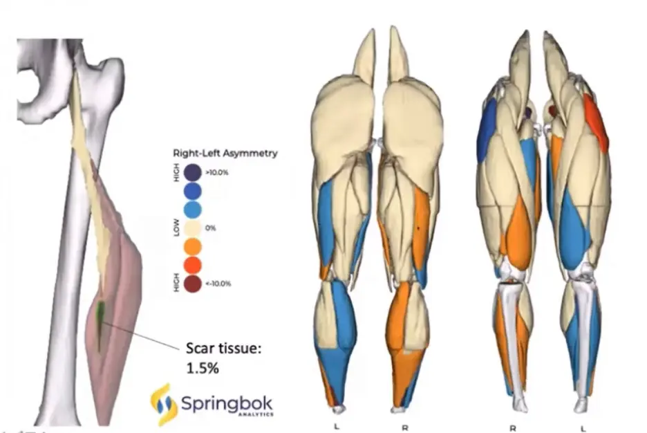 AI hamstring webinar image