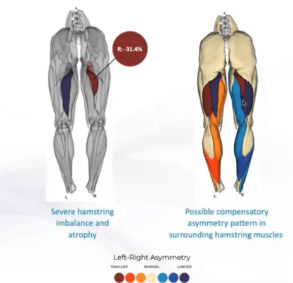 muscle by muscle analysis image