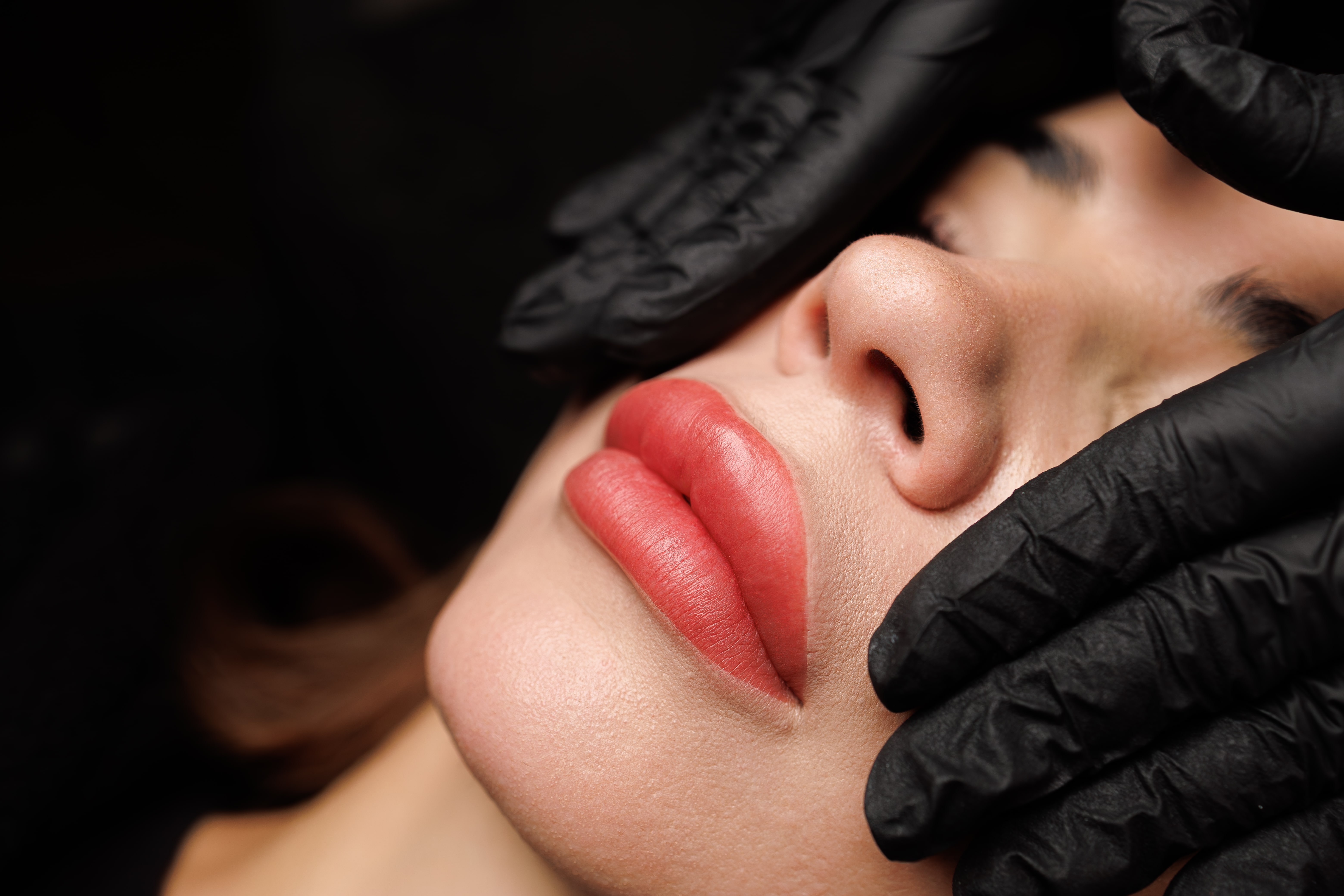 Dermal Fillers