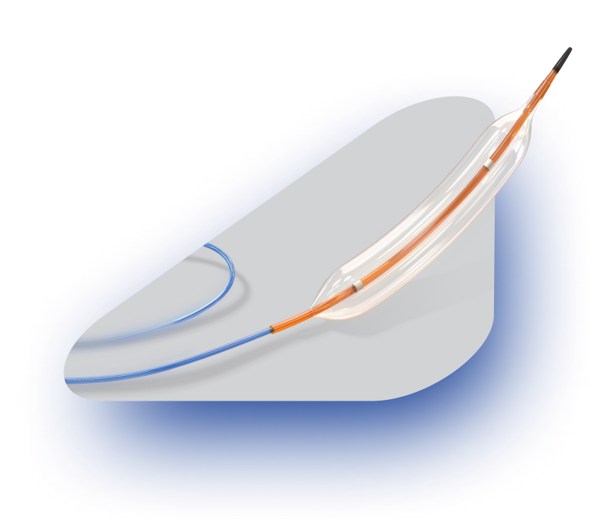 Intervention Cardiology
