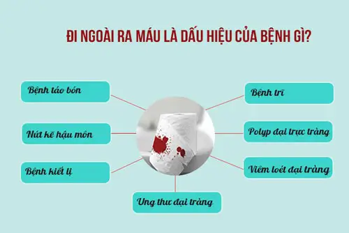 Hiện tượng đi ỉa ra máu tươi là bệnh gì, nguyên nhân