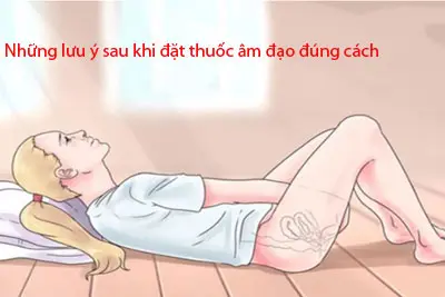 Những lưu ý sau khi đặt thuốc âm đạo đúng cách