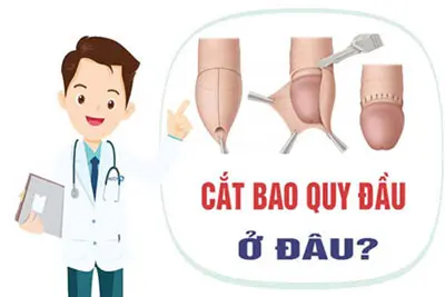 Cắt bao quy đầu ở đâu tốt?