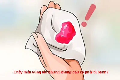 Chảy máu vùng kín nhưng không đau có phải bị bệnh?