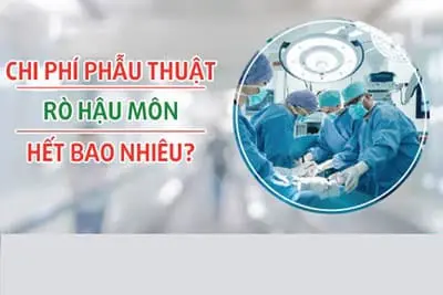 Chi phí phẫu thuật rò hậu môn hết bao nhiêu tiền 