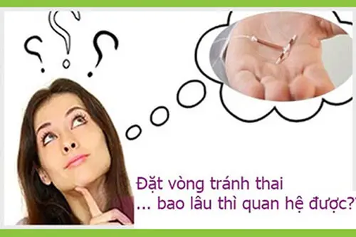 đặt vòng tránh thai bao lâu thì quan hệ được