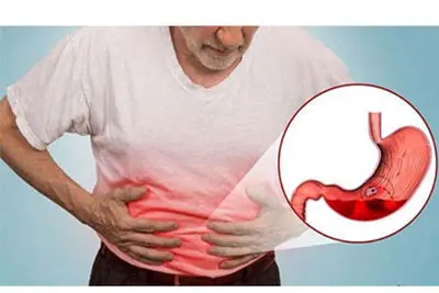 Đau bao tử là gì?