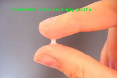 Ra nhiều khí hư hơn sau 2 ngày quan hệ