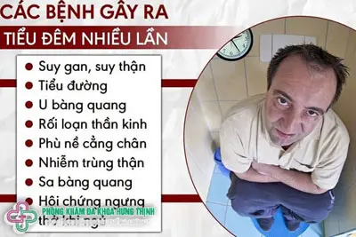 Nguyên nhân gây bệnh tiểu đêm thường gặp