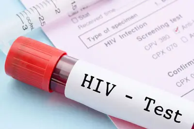 Khi nào người bệnh cần xét nghiệm HIV