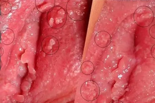 Gai sinh dục nữ là gì? 